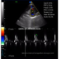 China Máquina do doppler da cor do eco do varredor do ultra-som do trole de Cardiac / OB / GYN